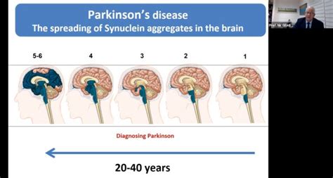 israel and parkinson's research